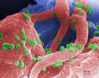 Teenager controls HIV infection without drugs