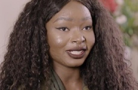 WATCH: More Than Skin Deep: How a burn victim became a beauty inspiration