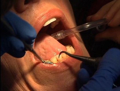 Report: Dental crisis could create ‘State of Decay’