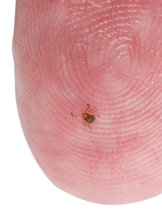 Practice Prevention Measures During Tickborne Disease Awareness Month, Throughout Tick Season