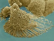 Scanning electron micrograph of an apoptotic HeLa cell using a Zeiss Merlin HR-SEM. NIH-funded work at the National Center for Microscopy and Imaging Research. 